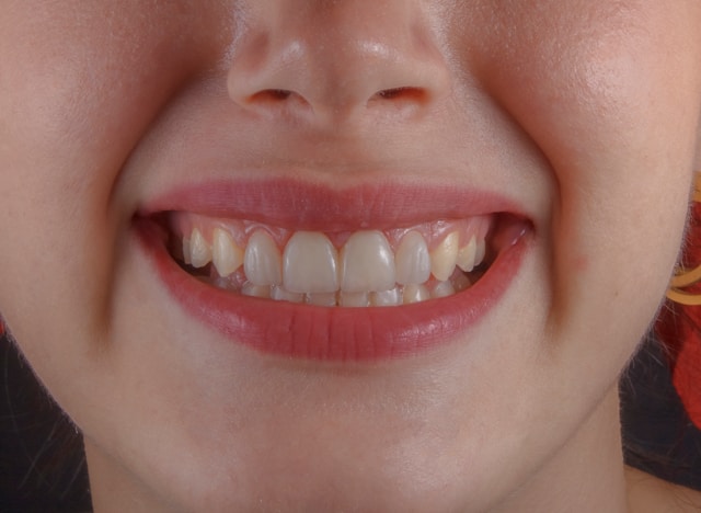 Qué esperar de una cirugía oral en Sevilla: guía completa con Dental Buhaira