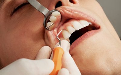 De la consulta a la sonrisa: experiencias reales en Clínica Dental Asián